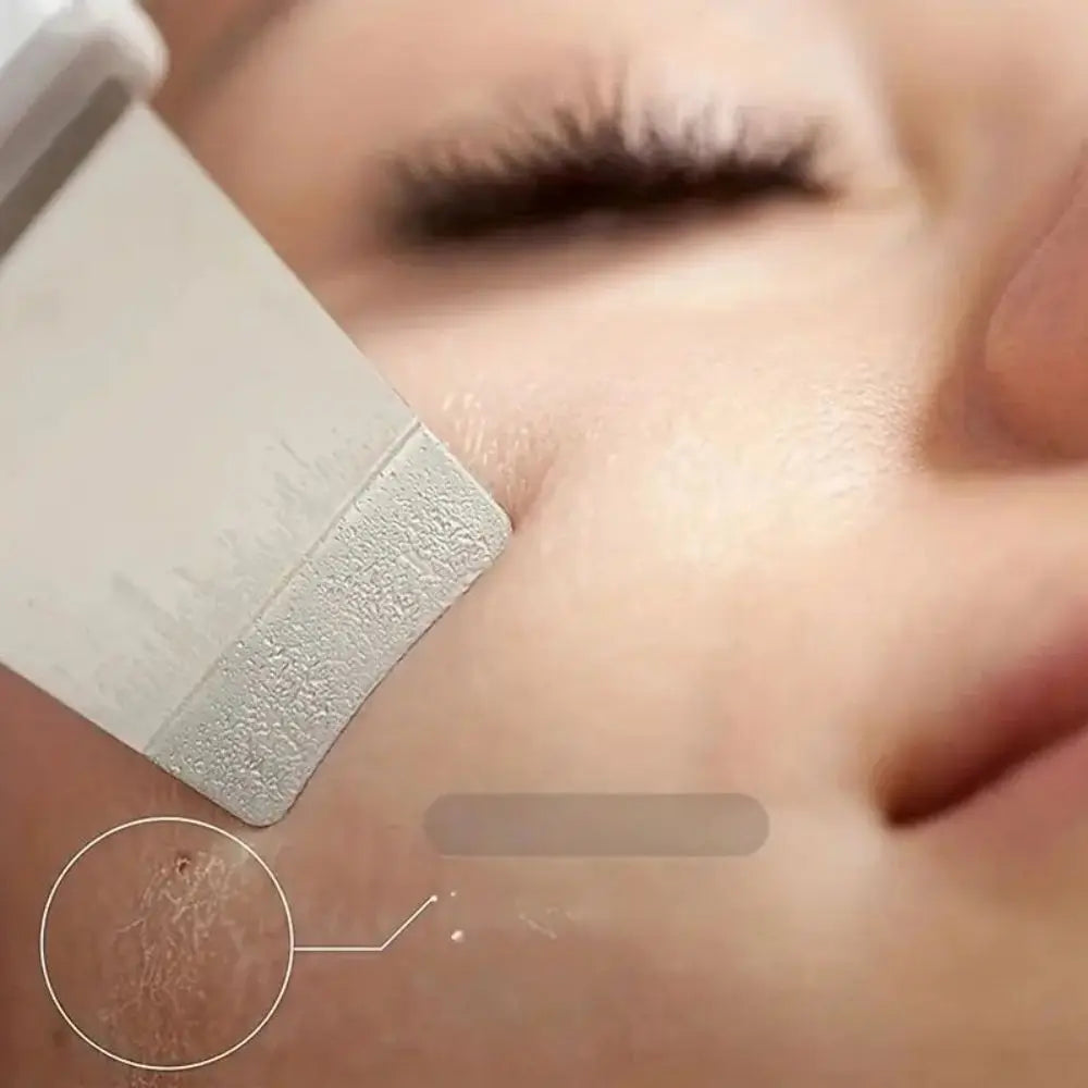 Ultrasonic Skin Scraper - Deep Pore Cleaner & Blackhead Remover