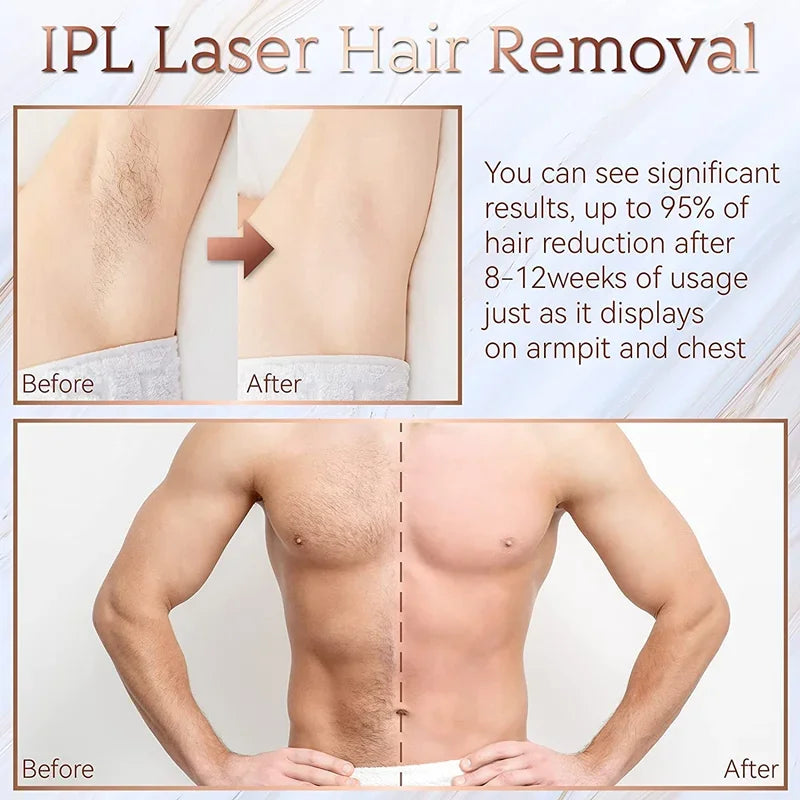 IPL Laser Epilator 999,999 Flashes Painless Hair Removal for Women & Men, Bikini & Body Trimmer, Home Use