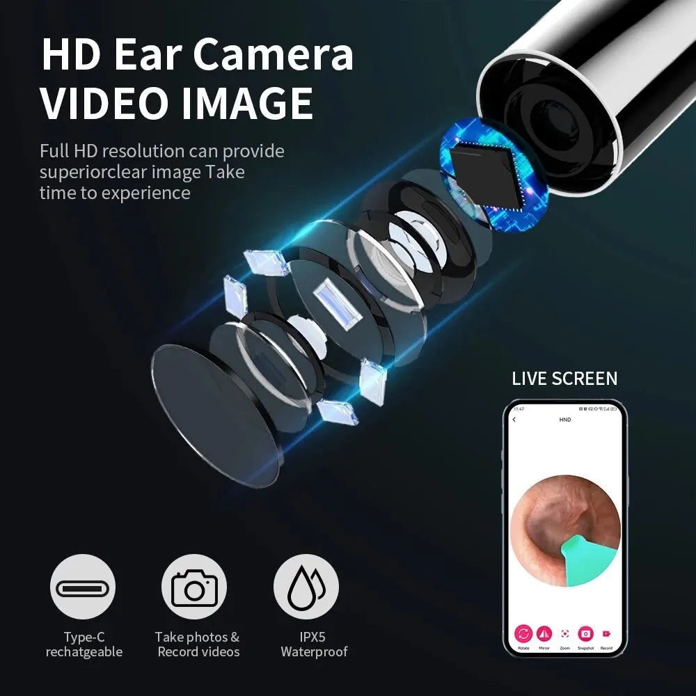 Wireless Ear Cleaner with Camera & LED Lights | 3.6mm Slim Lens for Ear Wax Removal