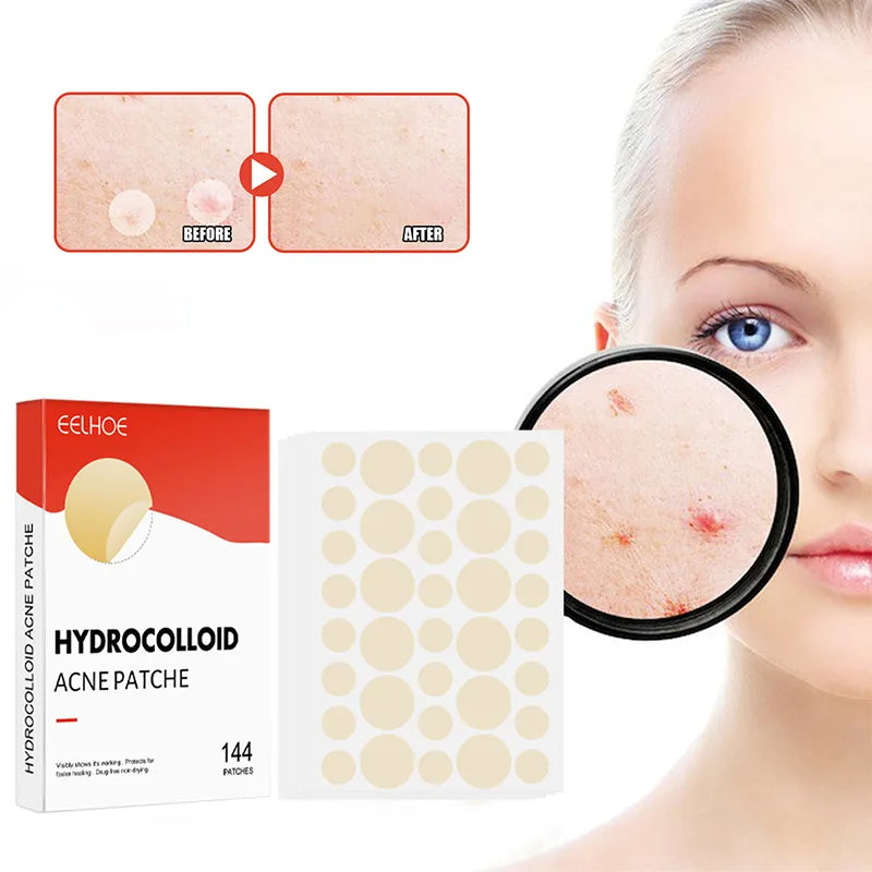 Face Skin Care Acne Pimple Patch 2 Sizes Invisible 144pcs/set