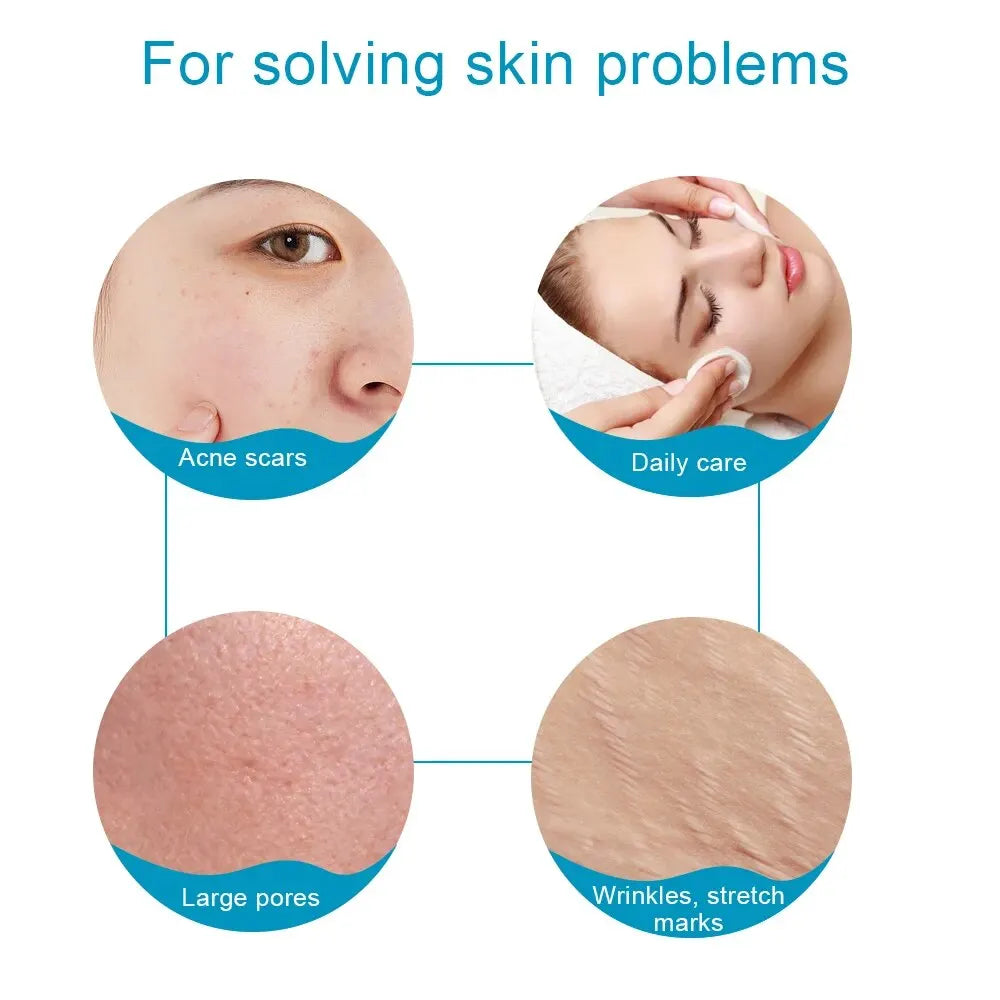 540 Micro Needle Derma Roller – Facial Skincare Tool for Reducing Wrinkles, Scars, Whitening & Skin Tightening